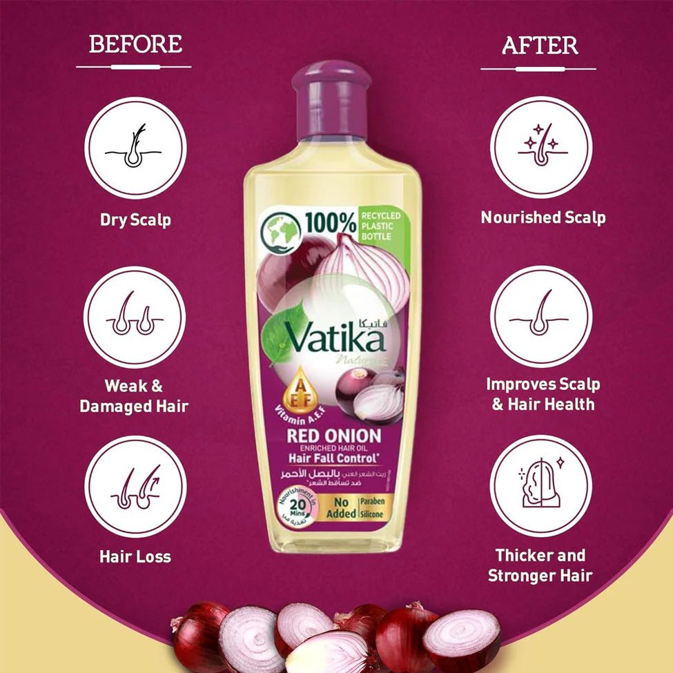 VATIKA RED ONION HAIR FALL CONTROL OIL 300ML - Anwar Store