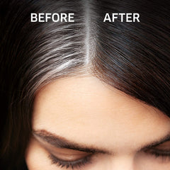 Koleston Root Touch Up Spray Medium Blonde -75 ml Anwar Store