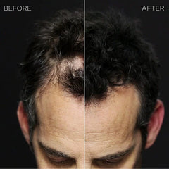 Toppik Hair Building Fibers and Thinning BLACK 27.5g Anwar Store