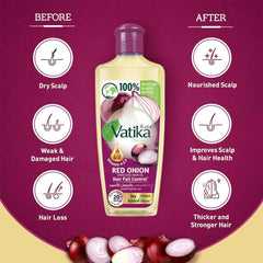 VATIKA RED ONION HAIR FALL CONTROL OIL 300ML